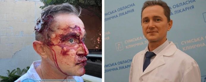 В Сумах ТЦКшники избили врача В Сумах ТЦКшники избили врача